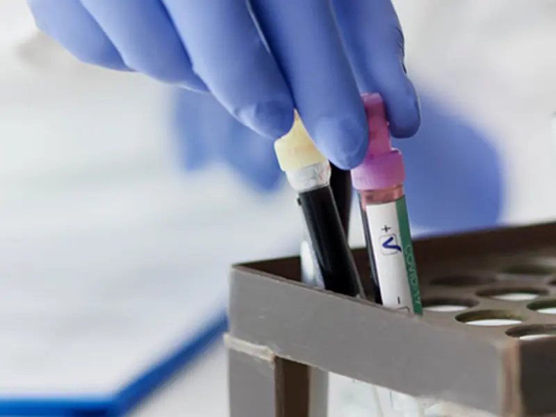 Détection d’Helicobacter pylori