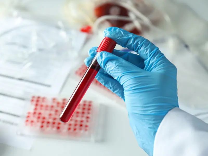 HÉMATOLOGIE - HÉMOSTASE